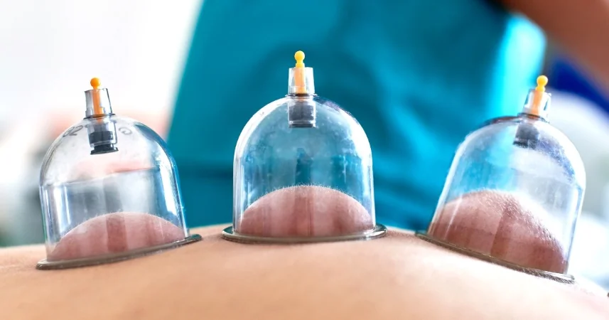 Que Signifie Hijama? 2 Bienfaits thérapeutiques de la Hijama
